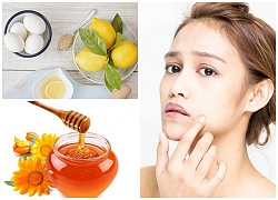 Bao nhiêu mụn ẩn, mụn đầu đen đều bay sạch sẽ chỉ với 1 quả trứng gà