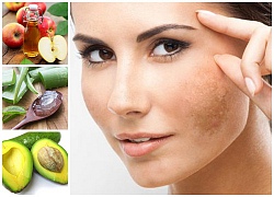 Bí Quyết Trị Nám Da Hiệu Quả Từ Thiên Nhiên