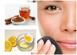 Hãy Làm Theo Cách Sau Đây Nếu Bạn Muốn "Tống Khứ" Mụn Đầu Đen Chi Chít