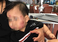 Mẹ "đăng đàn" tố nhà trường bạo hành con, những bức ảnh đính kèm khiến dân mạng phẫn nộ