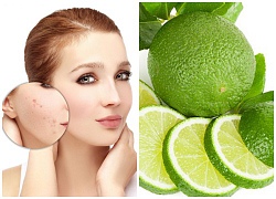 Sẹo lồi chẳng còn dù một vết nếu thực hiện các cách dưới đây