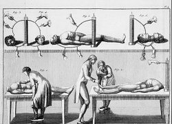 Thử nghiệm trên người chết tạo cảm hứng cho tiểu thuyết Frankenstein