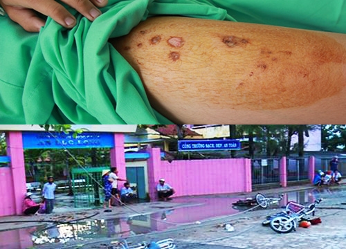 Buổi chiều định mệnh của hai học sinh bị điện giật trước cổng trường