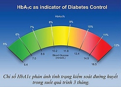 Phòng bệnh tiểu đường