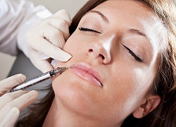 Tử vong sau khi tiêm 16 mũi botox làm đẹp