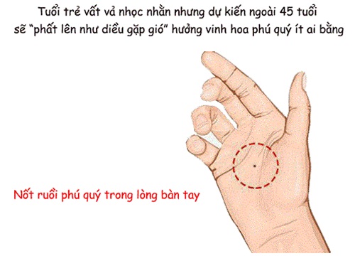 5 nốt ruồi trên cơ thể đem đến giàu sang phú quý, vượng tài phát lộc, kiểm tra xem bản thân có không nhé