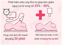 Tại sao phụ nữ phải chụp nhũ ảnh