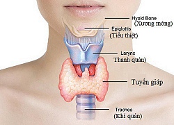 Hai vấn đề tuyến giáp nhiều người mắc phải