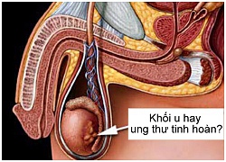 Những điều chưa biết về tinh hoàn