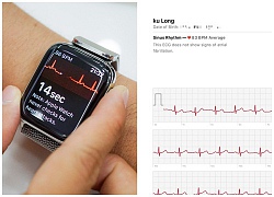 Trên tay ECG: App đo điện tâm đồ bằng Apple Watch 4 - Hiện máy cho thị trường Mỹ mới dùng được