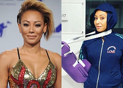 Mel B rách tay và gãy xương sườn vì ngã cầu thang