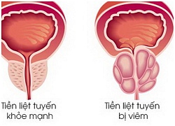 Nam giới bị đau khi yêu, đâu là thủ phạm?