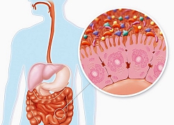 5 lời khuyên vàng cho hệ tiêu hóa khỏe mạnh