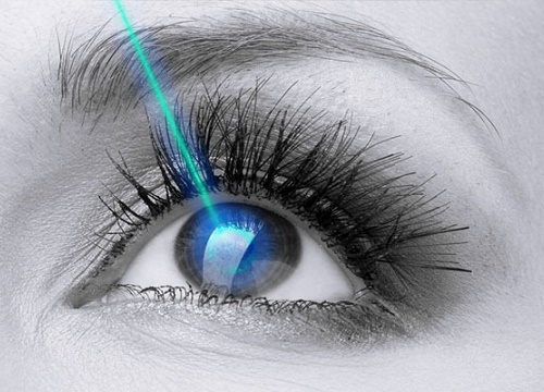 Những nguy cơ của phẫu thuật LASIK