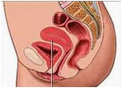 Phụ nữ đau khi giao hợp: Khi nào cần khám?