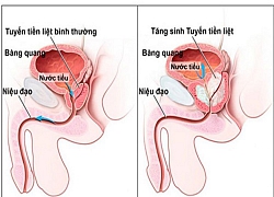 Bác sĩ bất ngờ vì người đàn ông tự nhét 3 con cá vào hậu môn