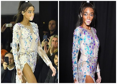 Thiên thần bạch biến Winnie Harlow mặc váy xuyên thấu soi rọi cơ thể tại Milan Fashion Week 2019