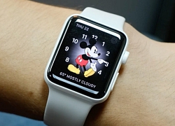 Dây đeo Apple Watch có thêm màu mới