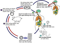 Không nên quá hoảng loạn vì sán heo