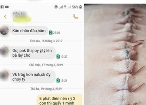 Tâm sự của nàng dâu sinh mổ chẳng được kiêng cữ, mẹ chồng bòn rút tiền đẻ, chồng ham chơi để mình vợ chăm con làm chị em rơi lệ