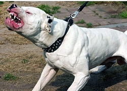 Bé 3 tuổi bị chó pitbull nặng 25 kg cắn nát đùi