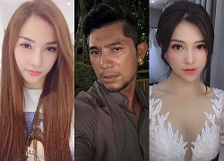 Phải chăng phẫu thuật thẩm mỹ đang trở thành trào lưu trong showbiz Việt?