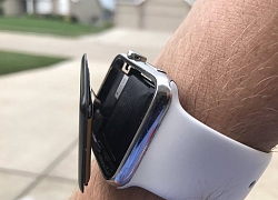 Apple đang bị kiện vì Apple Watch bị phồng pin gây nứt màn hình