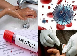 Khi nào cần điều trị dự phòng phơi nhiễm HIV và điều trị như thế nào?