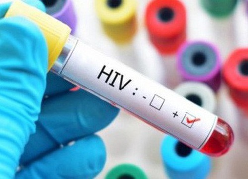 Cần 600 tỷ đồng/năm cho bệnh nhân HIV/AIDS