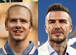 Beckham từng bị dự đoán hói đầu, rụng răng vào năm 2020