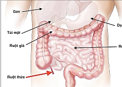 Gia đình bệnh nhân ký cam kết từ chối mổ, xin chuyển viện vì nghi bác sĩ chỉ định phẫu thuật quá chủ quan