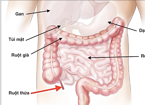 Gia đình bệnh nhân ký cam kết từ chối mổ, xin chuyển viện vì nghi bác sĩ chỉ định phẫu thuật quá chủ quan