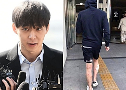 Giữa scandal "chất cấm", đôi chân lở loét, chi chít mụn phồng rộp của Yoochun trở thành tiêu điểm trên Weibo