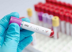 Triển vọng đẩy lùi lây nhiễm HIV/AIDS