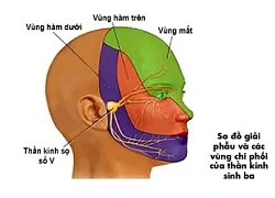 Bác sĩ hướng dẫn xử trí khi bị đau giật mặt