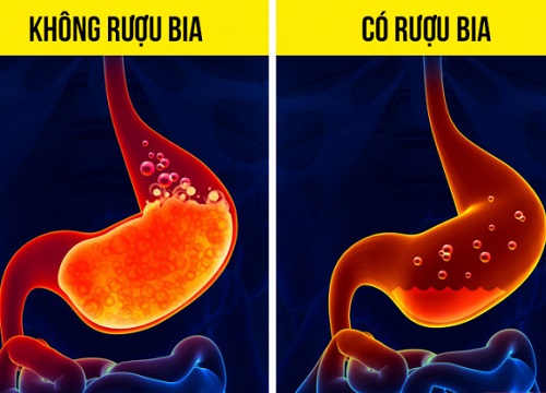 Những điều kỳ diệu đến với cơ thể nếu bạn bỏ rượu bia trong 28 ngày