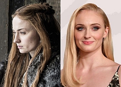 Đắng lòng 'Tiểu thư Sansa' Sophie Turner bị cấm gội đầu khi quay phim Game of Thrones