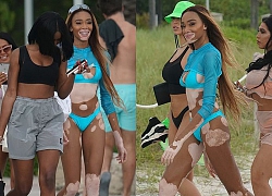 "Chân dài" bạch biến Winnie Harlow sải bước quyến rũ trên biển