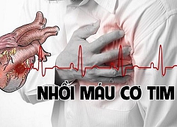 Vừa đến Hà Nội, một du khách đột ngột vỡ tim do nhồi máu cơ tim