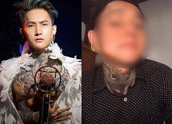 "Hotboy xăm trổ" lên mạng cầu cứu... thẩm mỹ hỏng