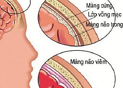 Dấu hiệu cảnh báo căn bệnh nguy hiểm khiến thanh thiếu niên tử vong đột ngột