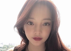 Goo Hara mắc bệnh trầm cảm nghiêm trọng trước khi tự tử