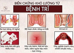 Vì sao bệnh trĩ hay "hỏi thăm" dân văn phòng?