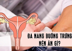 Phụ nữ bị mắc đa nang buồng trứng nên ăn gì để bệnh chóng khỏi, không lo vô sinh