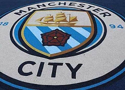 Nữ nhân viên trẻ của Man City bị phun chất lỏng ăn mòn vào mặt