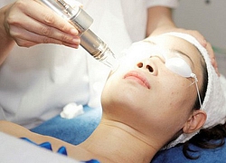 Làm đẹp da bằng laser cần chú ý điều này, tránh biến chứng "trời ơi" bỗng dưng ập đến