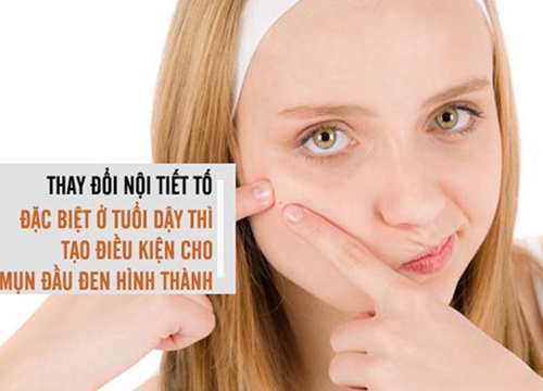 Làm sao để xóa mụn cám, mụn đầu đen sau vài tuần?