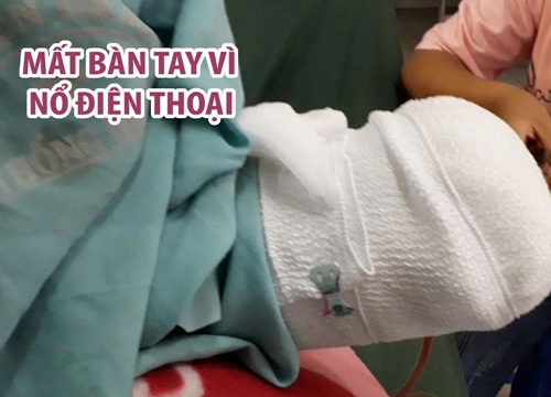 Nam thanh niên mất bàn tay vì nổ điện thoại