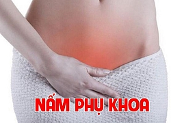 Những điều chị em nhất định phải biết về bệnh viêm nhiễm nấm phụ khoa