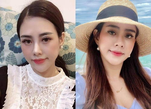 Sửa khuôn mặt thường thường bậc trung, cô gái tự tin xinh như hot girl